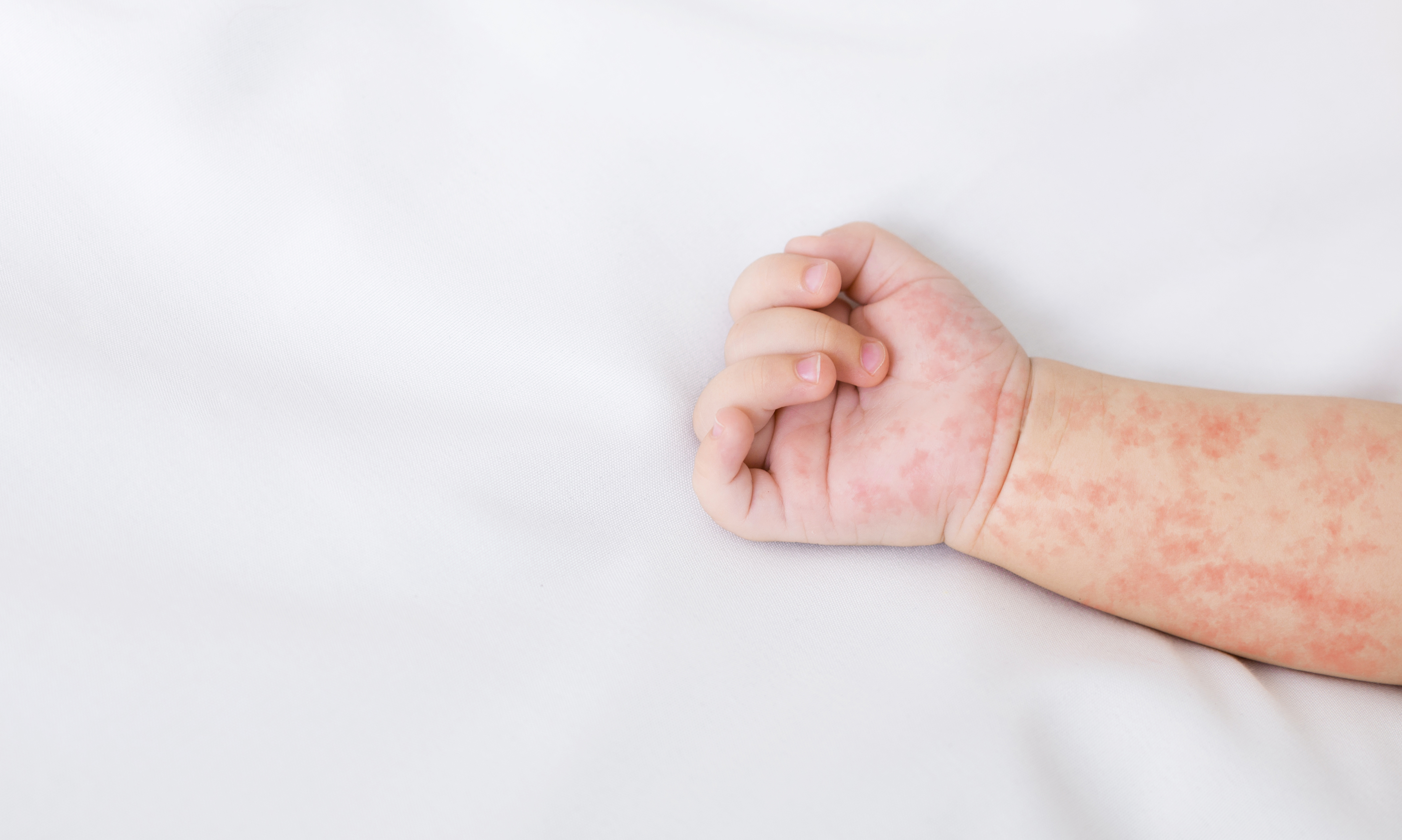 Articulațiile Mirenei doare tratamentul inflamației articulare cu uleiuri esențiale